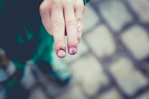 MD News Daily - Is Your Skin Turning Blue? Here’s What You Need to Know MD News Daily - Is Your Skin Turning Blue? Here’s What You Need to Know