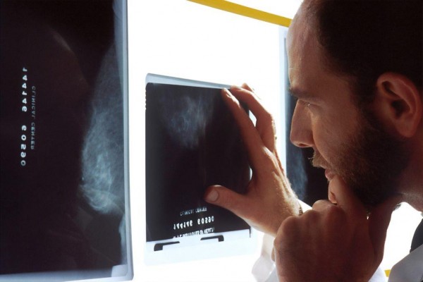 MD News Daily - Robot-Assisted ‘Ion’ Technology Help Improve Survival Rates of Lung Cancer MD News Daily - Robot-Assisted ‘Ion’ Technology Help Improve Survival Rates of Lung Cancer