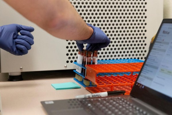 MD News Daily - First responders receive antibody testing for the COVID-19 in Arizona MD News Daily - First responders receive antibody testing for the COVID-19 in Arizona
