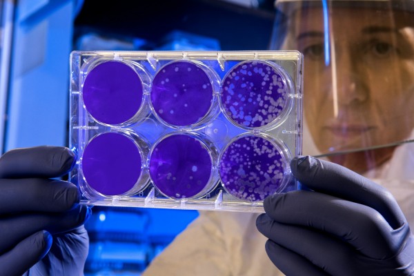 MD News Daily - Researchers Discover ‘Superbugs’ That Could Lead to Millions of Deaths Worldwide
