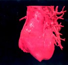 MD News Daily - Three Dimensional (3 D Image Displays A Computerised Visualization Of A Human Heart