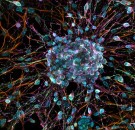 MD News Daily - Scientists Discover Neurons that Link to Stress, Insomnia and Immune System