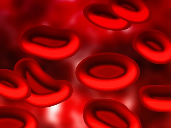 MD News Daily- End-Organ Damage Associated With Sickle Cell Disease Increases Economic Burden Among Patients
