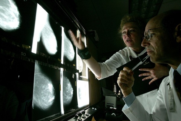 MD News Daily - First Time in More Than a Decade: Researchers Find a New Drug That Reduces Recurrence of Breast Cancer