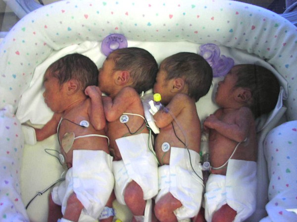 MD News Daily - After Brain Surgery, Dallas Mom Gives Birth to Quadruplets