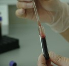 MD News Daily- Simple Routine Blood Test May Help Identify Mortality Risk Among COVID-19 Patients