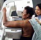 Breast Cancer Patient Gets Surprising Benefit From Cleveland Clinic’s Heart-Sparing Radiation Treatment