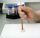 MD News Daily - Blood Test That Can Detect Alzheimer’s Disease Now Available for Clinical Use