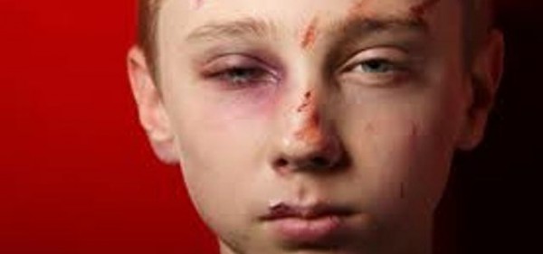 child abuse child abuse