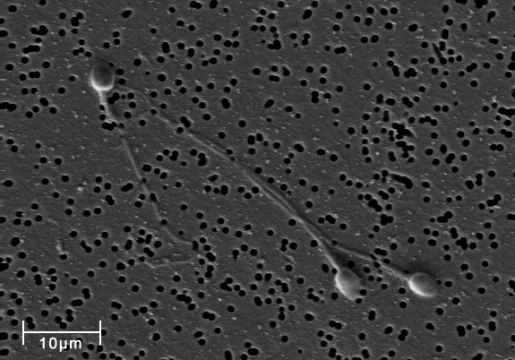 Sperm Sperm
