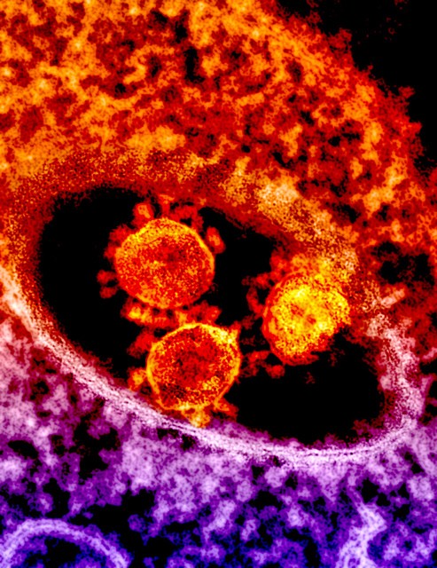 MERS virus MERS virus