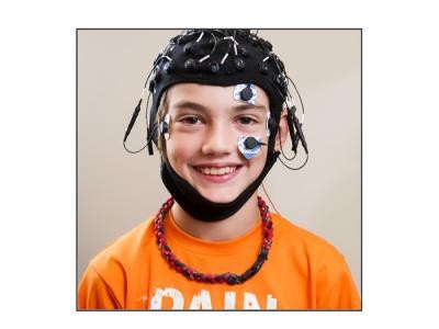 Electroencephalography