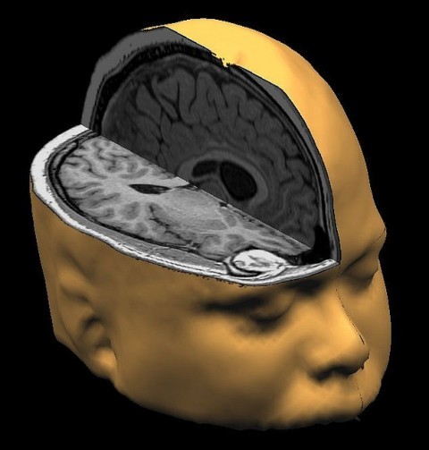 Going to Sleep After Learning Improves Memory Power Going to Sleep After Learning Improves Memory Power