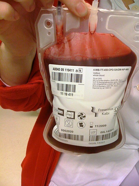 Donating Blood Averts Heart Attack and Stroke Risk Donating Blood Averts Heart Attack and Stroke Risk