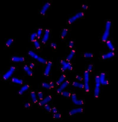 An Electron Micrograph Showing Telomeres in Red An Electron Micrograph Showing Telomeres in Red