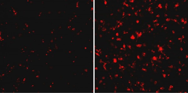 Ebola virus (red) replicates much faster in human macrophages depleted of RBBP6 protein 