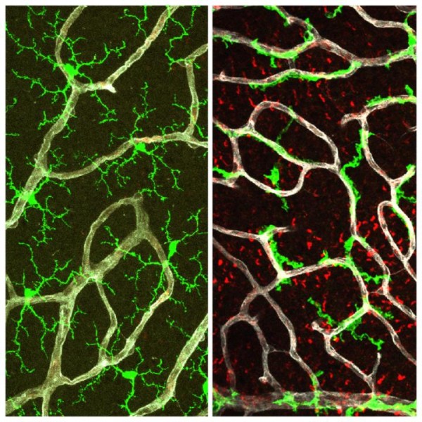 Retina With and Without TGF-Beta Signaling (IMAGE)