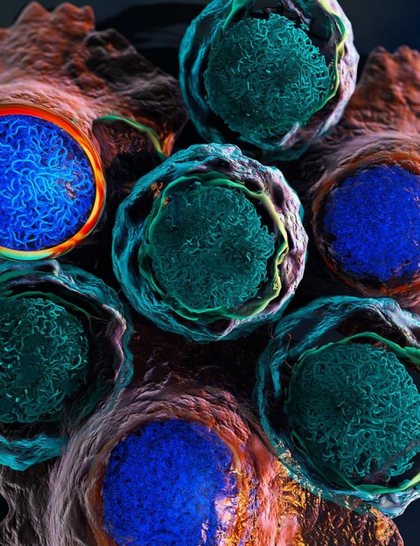 Leukemia Cells Undergoing Drug Screening (Illustration) (IMAGE)