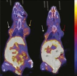 18F-FFNP Uptake in Tumor Xenografts Expressing PR-A or PR-B (IMAGE)
