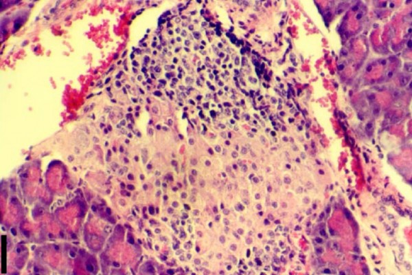 Image from Journal of Autoimmune Diseases