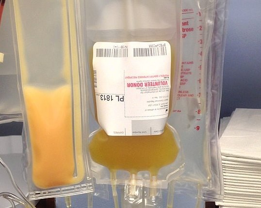 Recommendation for platelet donation is every two weeks.