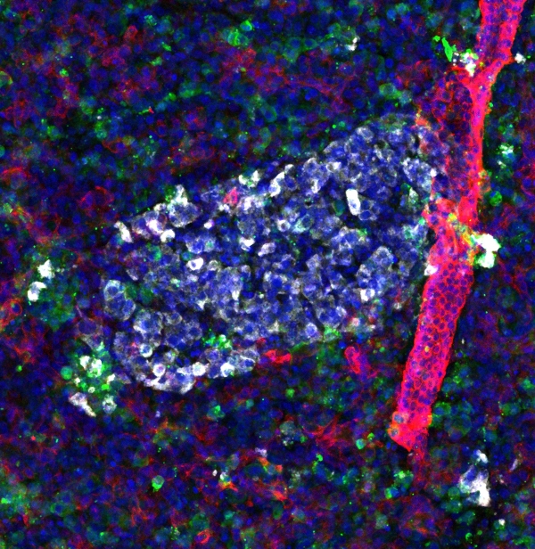 MD News Daily - Long-term culture of human pancreatic slices as a model to study real-time islet regeneration