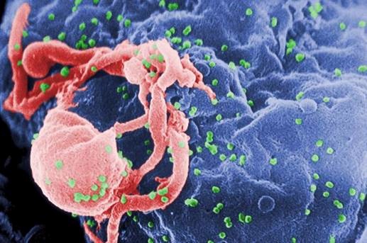 HIV, virus HIV, virus