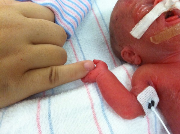 premature baby preemie