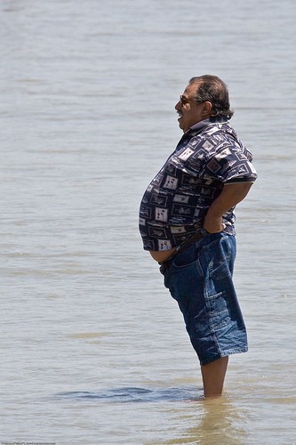 Obesity in Adults Obesity in Adults