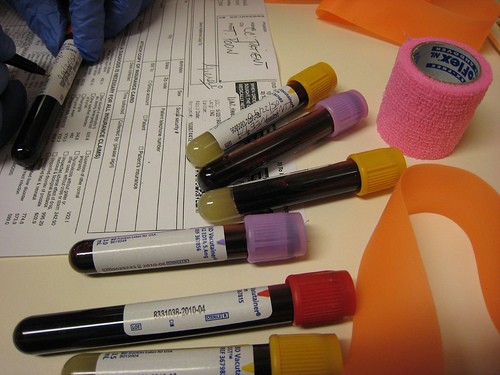 Blood Test Vials Blood Test Vials
