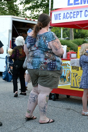 Obese Woman