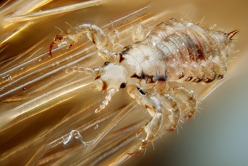 Head Lice, Louse