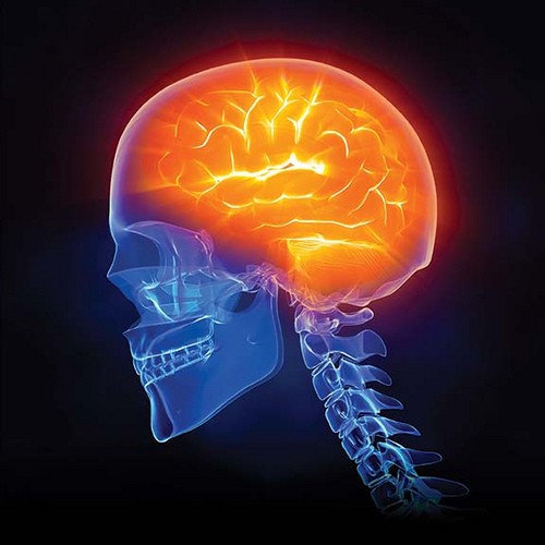 Brain Brain