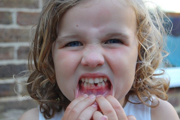 Depression can cause Tooth Loss Depression can cause Tooth Loss