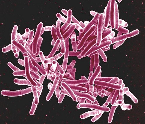 Tuberculosis Tuberculosis