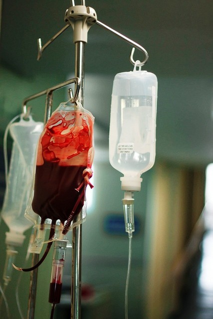 More the Number of Blood Transfusions Higher the Risks of Infections More the Number of Blood Transfusions Higher the Risks of Infections